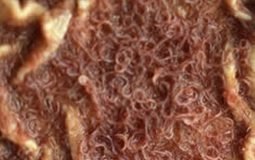 Haemonchus Contortus