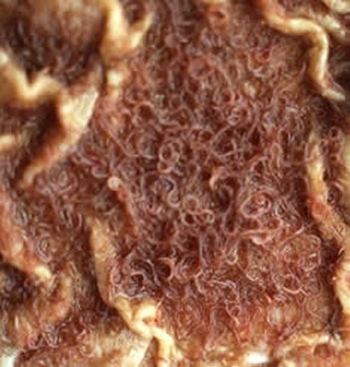 Haemonchus Contortus